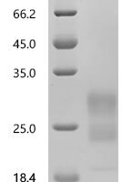 Mouse Interferon gamma (Ifng), Biotinylated Recombinant Protein - BioCrest Sci