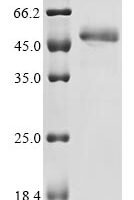 Candida albicans Candidapepsin-2 (SAP2) Recombinant Protein, C-His-Myc - BioCrest Sci