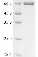 Human DCC-interacting protein 13-alpha (APPL1), partial Recombinant Protein - BioCrest Sci