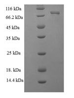 Helicobacter pylori Glutamate--tRNA ligase 1 (gltX1) Recombinant Protein, Helicobacter pylori (strain ATCC 700392 / 26695) (Campylobacter pylori), E.coli, N-terminal 6xHis-SUMO-tagged, 69.4 kDa, purity >≥ 90% as determined by SDS-PAGE.
