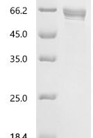 Mouse C-type lectin domain family 4 member K (Cd207), partial Recombinant Protein - BioCrest Sci