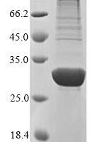Human Angiopoietin-like protein 8 (ANGPTL8) Recombinant Protein - BioCrest Sci