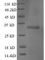 Human Ubiquitin-conjugating enzyme E2 W (UBE2W) Recombinant Protein - BioCrest Sci