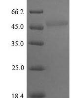 Saccharomyces cerevisiae Polyphosphatase (PPX1) Recombinant Protein - BioCrest Sci