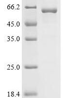 Mouse Bile acid receptor (Nr1h4) Recombinant Protein - BioCrest Sci