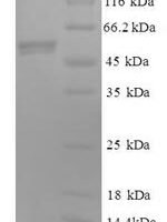 Human Cytochrome c1, heme protein, mitochondrial (CYC1) Recombinant Protein, N-GST - BioCrest Sci
