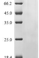 Human Protocadherin-19 (PCDH19), partial Recombinant Protein - BioCrest Sci