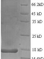 Rabbit Interleukin 17A (IL17A), partial Recombinant Protein, N-His - BioCrest Sci