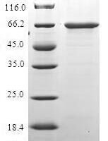 Human Histone deacetylase 11 (HDAC11) Recombinant Protein, N-GST - BioCrest Sci