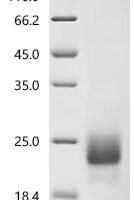 Human Cytotoxic T-lymphocyte protein 4 (CTLA4), partial Recombinant Protein, C-10His - BioCrest Sci