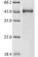 Yersinia enterocolitica serotype O:8 / biotype 1B Propionate kinase (tdcD) Recombinant Protein, C-His - BioCrest Sci