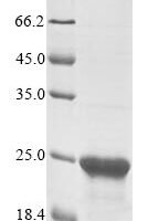 Human Splicing regulatory glutamine/lysine-rich protein 1 (SREK1), partial Recombinant Protein - BioCrest Sci