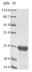Human Splicing regulatory glutamine/lysine-rich protein 1 (SREK1), partial Recombinant Protein, Homo sapiens (Human), E.coli, N-terminal 10xHis-tagged and C-terminal Myc-tagged, 17.3 kDa, purity >≥ 85% as determined by SDS-PAGE.