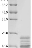 Mouse Interleukin-2 (Il2) Recombinant Protein, C-10His - BioCrest Sci