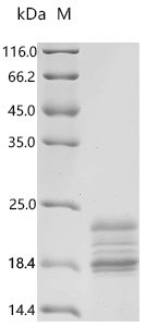 Mouse Interleukin-2 (Il2) Recombinant Protein, C-10His, Mus musculus (Mouse), Yeast, C-terminal 10xHis-tagged, 19.3 kDa, purity >≥ 95% as determined by SDS-PAGE.