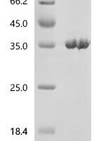 Ricinus communis Ricin, partial Recombinant Protein, C-His - BioCrest Sci