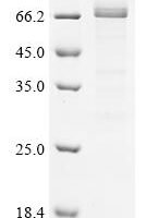 Human Serine/threonine-protein kinase RIO3 (RIOK3) Recombinant Protein - BioCrest Sci
