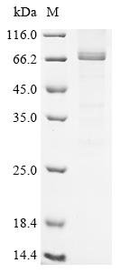 Human Serine/threonine-protein kinase RIO3 (RIOK3) Recombinant Protein, Homo sapiens (Human), Baculovirus, C-terminal 6xHis-tagged, 64.7 kDa, purity >≥ 85% as determined by SDS-PAGE.