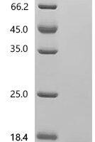 Human Platelet-derived growth factor subunit B (PDGFB) Recombinant Protein, C-10His - BioCrest Sci