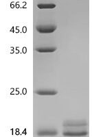 Rat Interleukin-2 (Il2) Recombinant Protein, N-10His - BioCrest Sci
