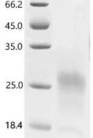 Human Prostate stem cell antigen (PSCA) Recombinant Protein, C-10His - BioCrest Sci
