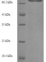 Human Electron transfer flavoprotein-ubiquinone oxidoreductase, mitochondrial (ETFDH) Recombinant Protein, N-His-SUMO - BioCrest Sci