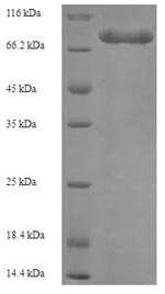 Human Electron transfer flavoprotein-ubiquinone oxidoreductase, mitochondrial (ETFDH) Recombinant Protein, N-His-SUMO, Homo sapiens (Human), E.coli, N-terminal 6xHis-SUMO-tagged, 80.7 kDa, purity >≥ 90% as determined by SDS-PAGE.
