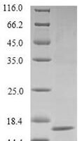 Vaccinia virus Protein OPG154 (OPG154) Recombinant Protein - BioCrest Sci