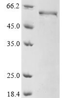 Mouse Ena/VASP-like protein (Evl) Recombinant Protein - BioCrest Sci