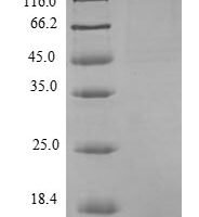 Human Interferon alpha-inducible protein 6 (IFI6) Recombinant Protein - BioCrest Sci
