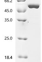Human Creatine kinase U-type, mitochondrial (CKMT1A) Recombinant Protein, C-His - BioCrest Sci