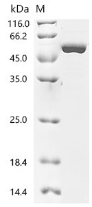Human Creatine kinase U-type, mitochondrial (CKMT1A) Recombinant Protein, C-His, E.coli, C-terminal 6xHis-tagged, 50.0 kDa, purity >≥ 90% as determined by SDS-PAGE.