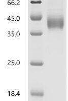 Rat Interleukin-2 receptor subunit beta (Il2rb), partial Recombinant Protein - BioCrest Sci