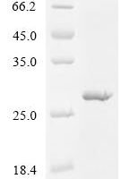 Arabidopsis thaliana Pectinesterase inhibitor 1 (PMEI1) Recombinant Protein - BioCrest Sci