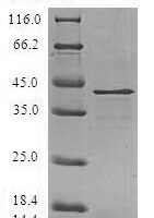Human Ragulator complex protein LAMTOR3 (LAMTOR3) Recombinant Protein, N-GST - BioCrest Sci