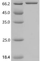 Arachis hypogaea Allergen Ara h 1, clone P41B, partial Recombinant Protein - BioCrest Sci