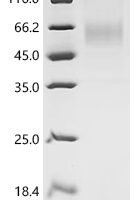 Dog Parathyroid hormone/parathyroid hormone-related peptide receptor (PTH1R), partial Recombinant Protein, C-His, aa 27–188, Mammalian cell - BioCrest Sci