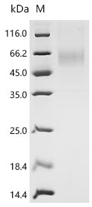Dog Parathyroid hormone/parathyroid hormone-related peptide receptor (PTH1R), partial Recombinant Protein, C-His, aa 27–188, Mammalian cell, Canis lupus familiaris (Dog) (Canis familiaris), Mammalian cell, C-terminal 6xHis-tagged, 41.7 kDa, purity >≥ 90% as determined by SDS-PAGE.