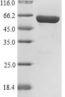 Mouse Putative phospholipase B-like 2 (Plbd2) Recombinant Protein, N-His, aa 47–594, Yeast - BioCrest Sci