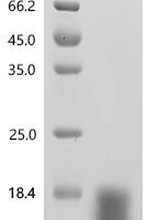 Mouse Ly-6/neurotoxin-like protein 1 (Lynx1) Recombinant Protein, N-His - BioCrest Sci