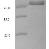 Escherichia coli Adenosine deaminase (add) Recombinant Protein - BioCrest Sci
