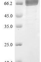 Mouse Phospholipid transfer protein (Pltp) Recombinant Protein, C-10His - BioCrest Sci