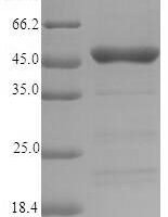Lolium perenne Major pollen allergen Lol p 5a (LOLPIB) Recombinant Protein, N-10His-SUMO/C-Myc - BioCrest Sci