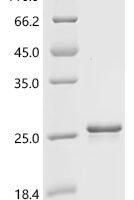 Human Interferon gamma (IFNG) Recombinant Protein, N-His - BioCrest Sci