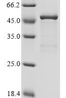 Apis mellifera Venom acid phosphatase Acph-1 Recombinant Protein, N-10His/C-Myc - BioCrest Sci