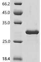 Human Cell division control protein 42 homolog (CDC42) Recombinant Protein, C-His - BioCrest Sci