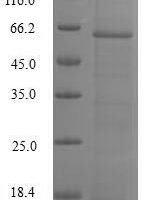 Human DNA fragmentation factor subunit alpha (DFFA) Recombinant Protein - BioCrest Sci