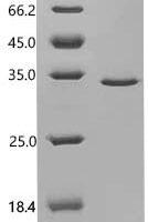 Mouse Thrombospondin-2 (Thbs2) Recombinant Protein - BioCrest Sci