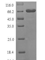 Mouse Desmoglein-3 (Dsg3), partial Recombinant Protein, N-His - BioCrest Sci