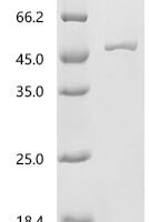 Japanese encephalitis virus Envelope protein (E), partial Recombinant Protein - BioCrest Sci